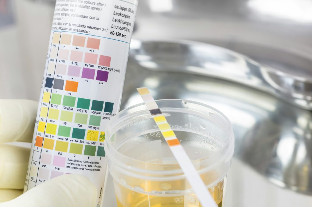 Routine test, urine rapid test, urine test strip, urine sample